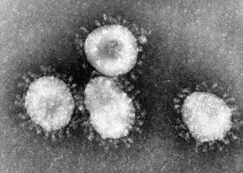 1024px-Coronaviruses_004_lores